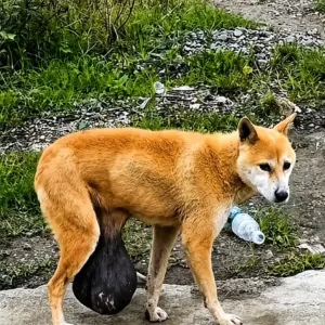 They Abandoned Her Because of a Giant Tumor